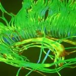 The Creative Brain How Insight Works