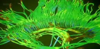 The Creative Brain How Insight Works