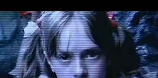 Mystery Diagnosis: Cerebrotendinous Xanthomatosis