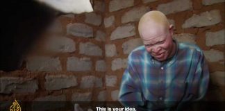 The Spell of the Albino