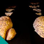 The Brain, the Last Enigma