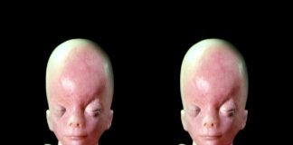 In the Womb: Identical Twins