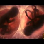 In the Womb: Multiples