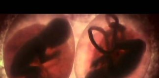 In the Womb: Multiples