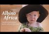 Albino Africa