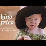 Albino Africa