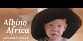 Albino Africa