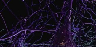 The Brain: Our Universe Within