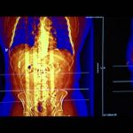 The Weight of the Nation: Consequences